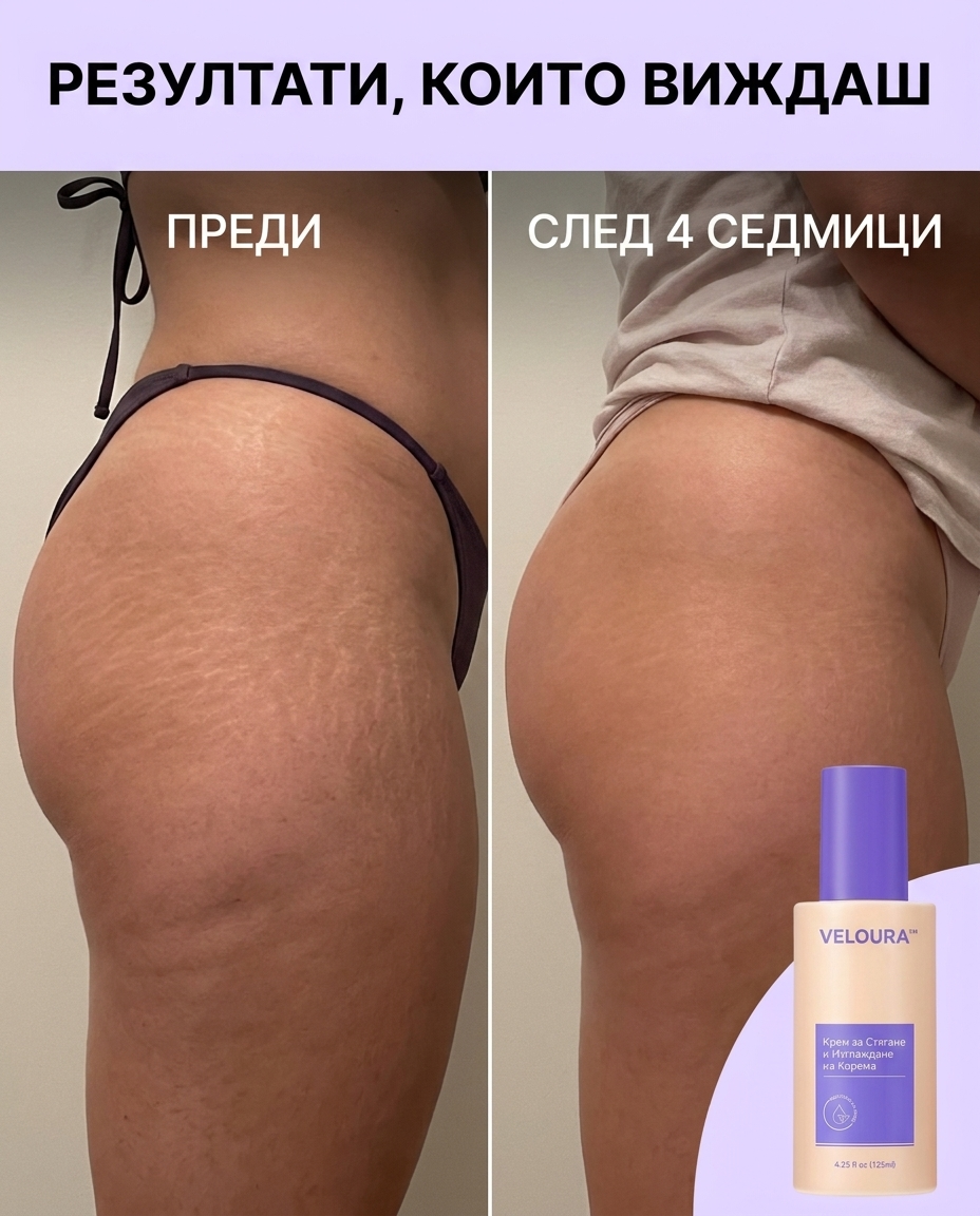 VELOURA™ — Крем срещу Стрии и за Стягане на Тялото, 125мл