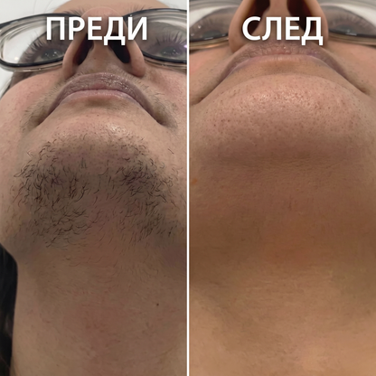 VELOURA™ Масло за намаляване на растежа на космите, 60мл