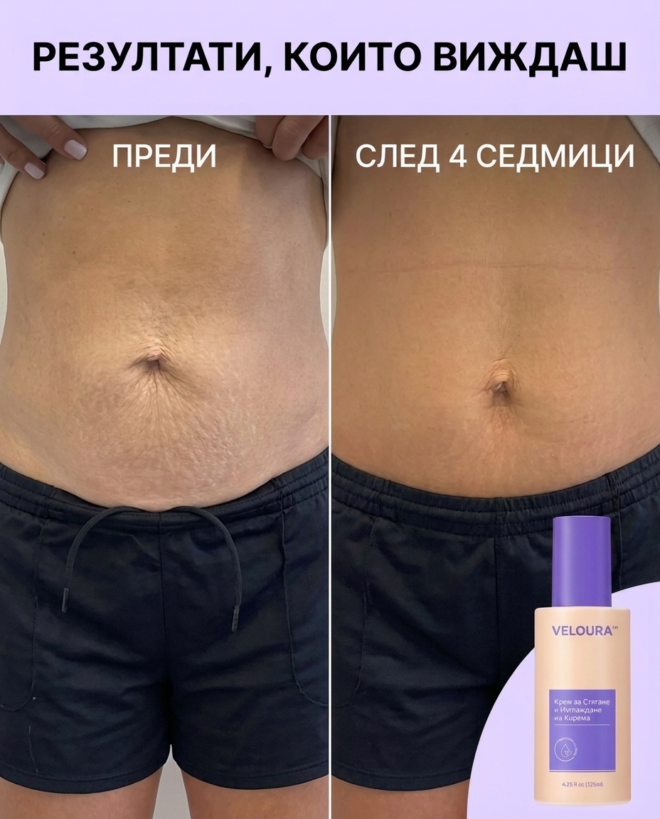 VELOURA™ — Крем срещу Стрии и за Стягане на Тялото, 125мл